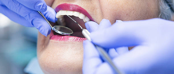 Best Knocked-Out Tooth Emergency  in Alma, NE